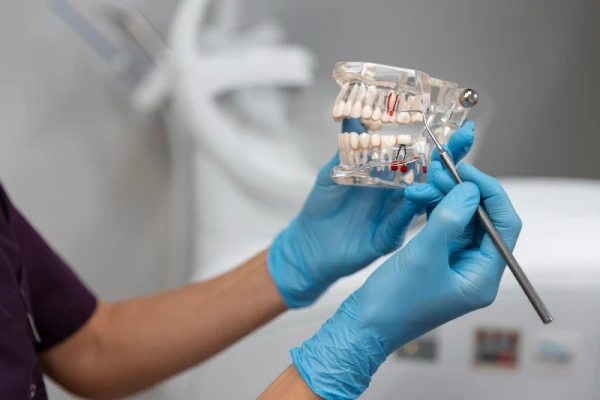 Complex Oral Rehabilitation Services