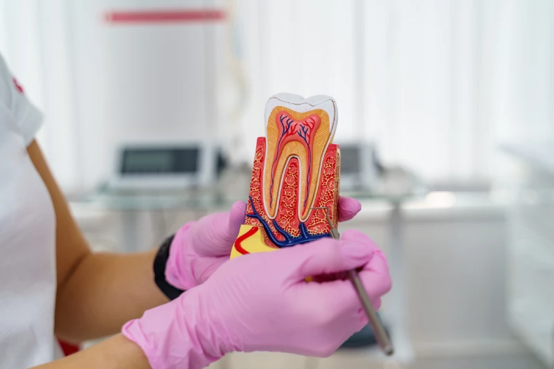 How to know if you need a root canal