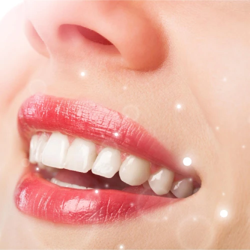 Teeth Whitening in Chelmsford MA